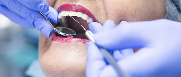 Best Urgent Dental Care for Toothaches in Stepping Stone, CO